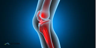 Knee Pain